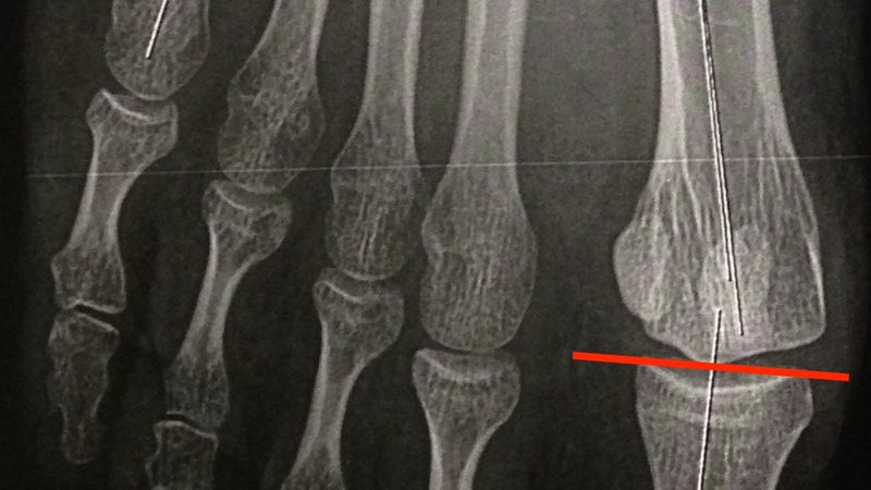 轮胎生产厂家排名及优缺点对比：揭秘行业佼佼者背后的秘密